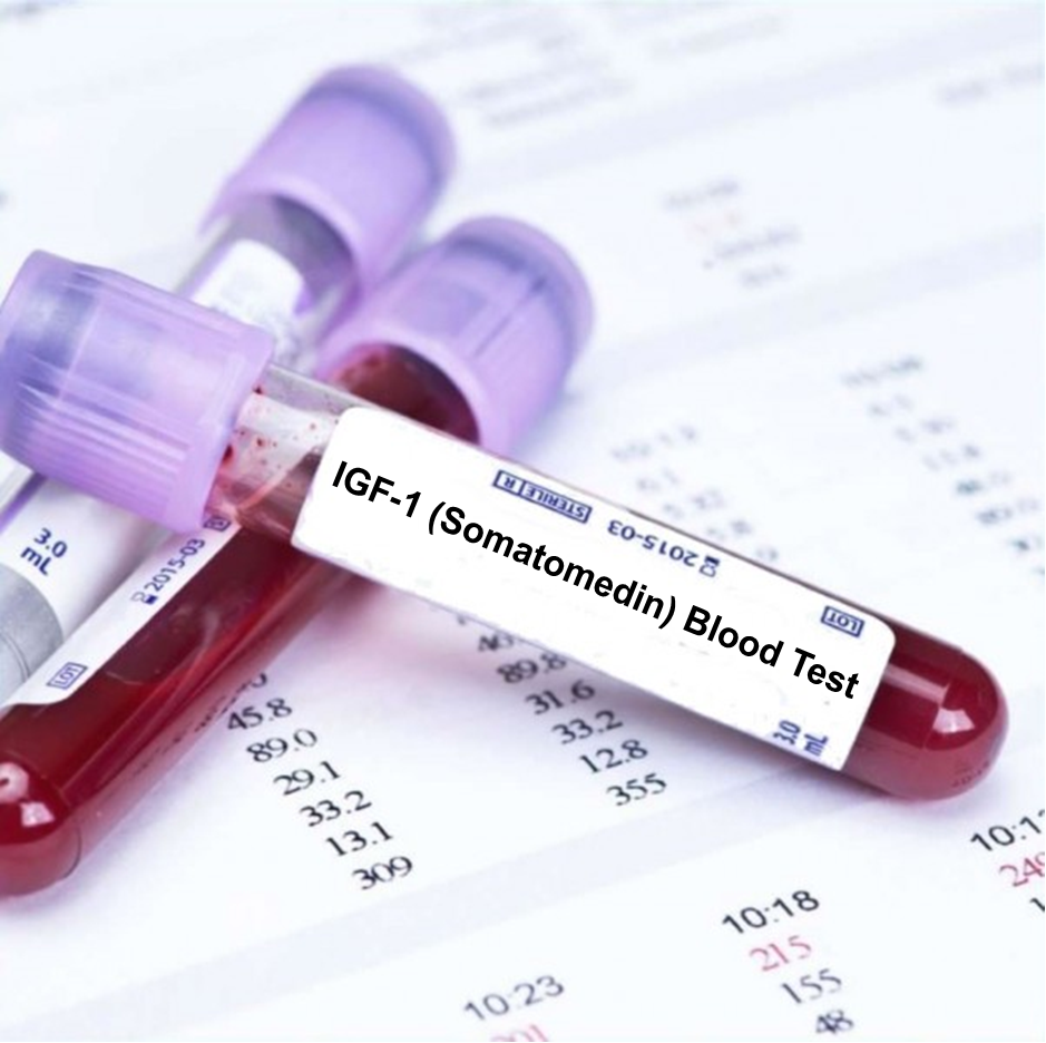 IGF-1 Somatomedin Blood Test In London - Order Online Today – Blood ...