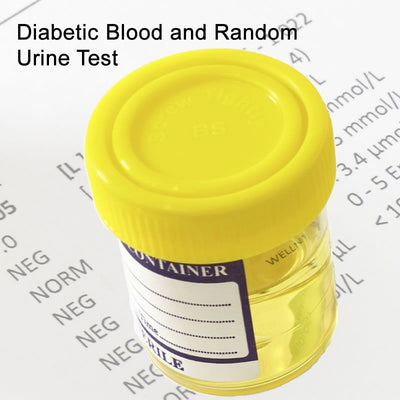 Diabetic Profile 2 Blood and Urine Test Profile In London