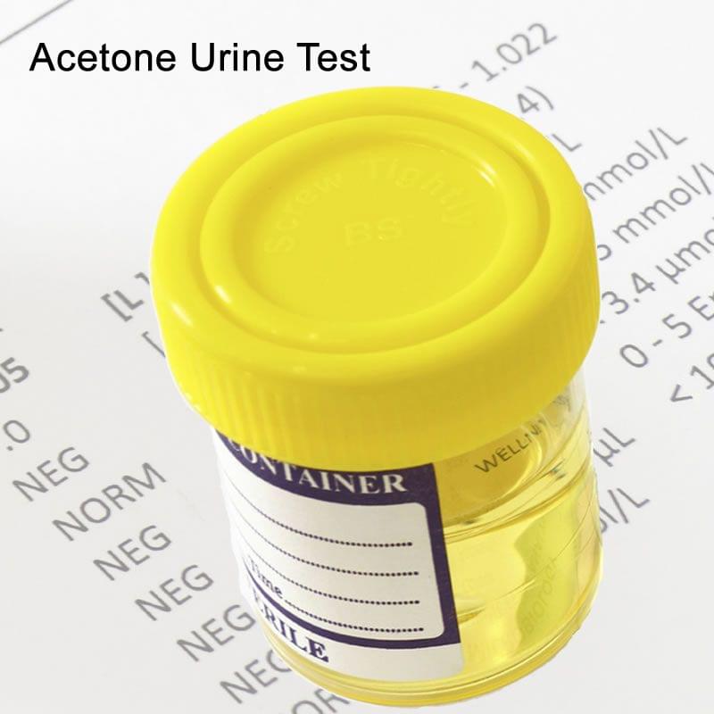 Acetone Urine Test In London - Order Online - Attend Clinic
