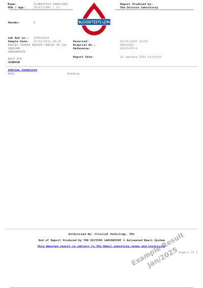Haemoglobin Electrophoresis Blood Test In London