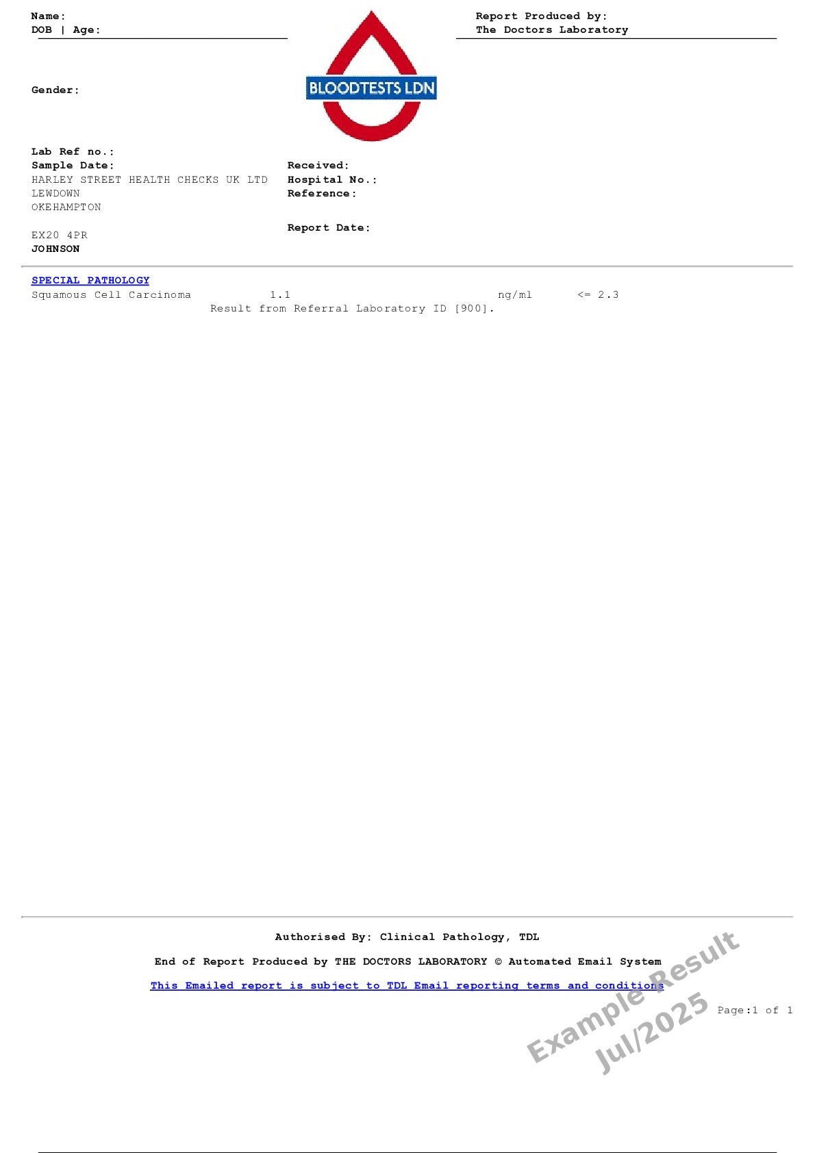 Squamous Cell Carcinoma Blood Test In London - Order Online