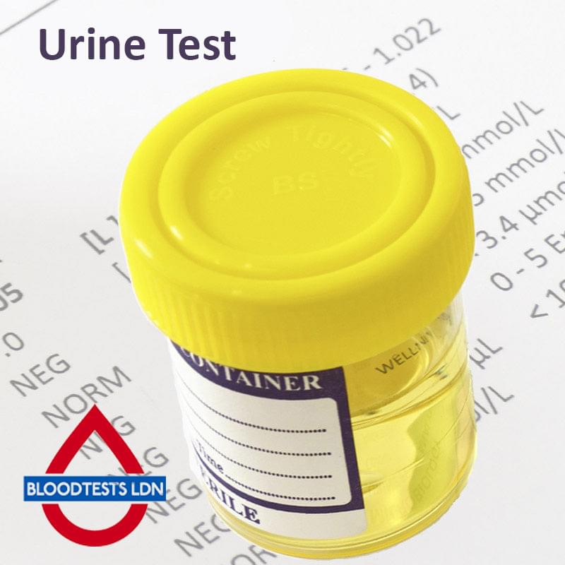 Aldosterone Urine Test In London - Order Online - Attend
