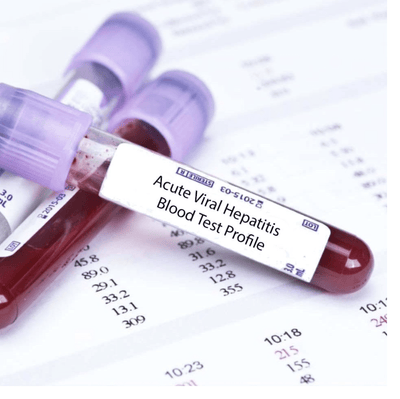 Acute Viral Hepatitis Blood Test Profile In London