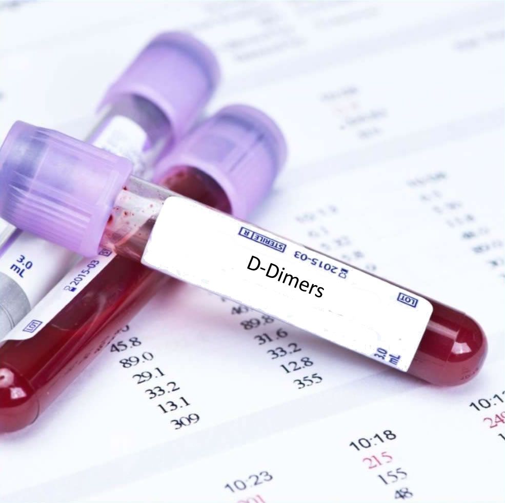 D-Dimer Blood Test In London - Order Online - Attend Clinic