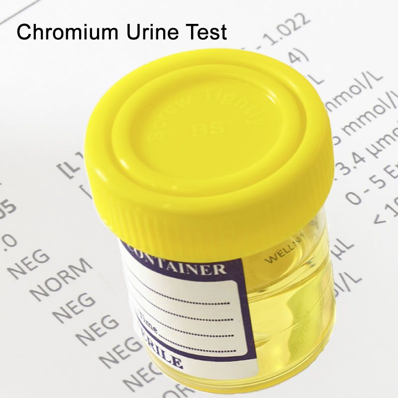 Chromium Urine Test In London - Order Online - Attend Clinic