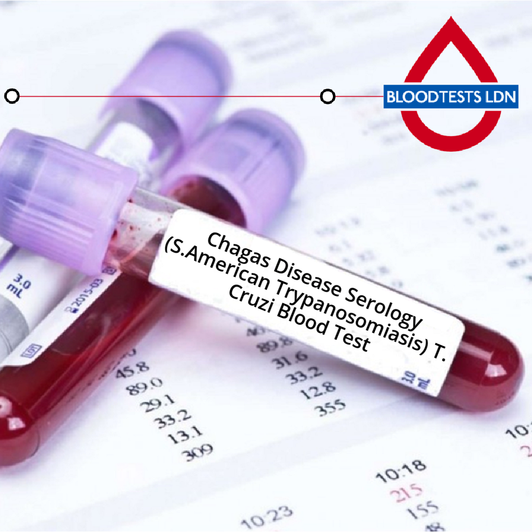 Chagas Disease Serology  T- Cruzi Blood Test In London