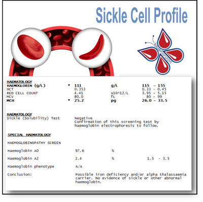 Sickle Cell Blood Test Profile In London - Order Online Today